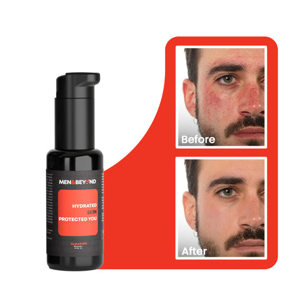 HydraX SPF Moisturizer